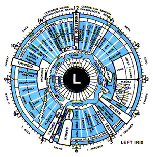 Detox w/ detailed Iridology Assessment